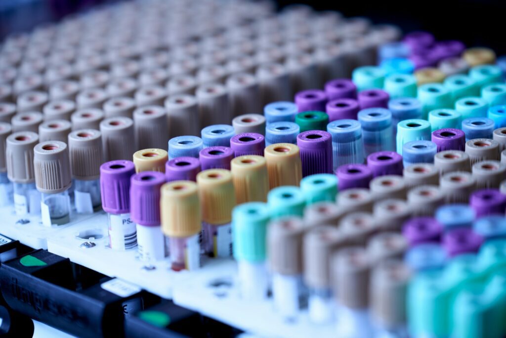 Blood collection tubes with colored caps in a laboratory rack